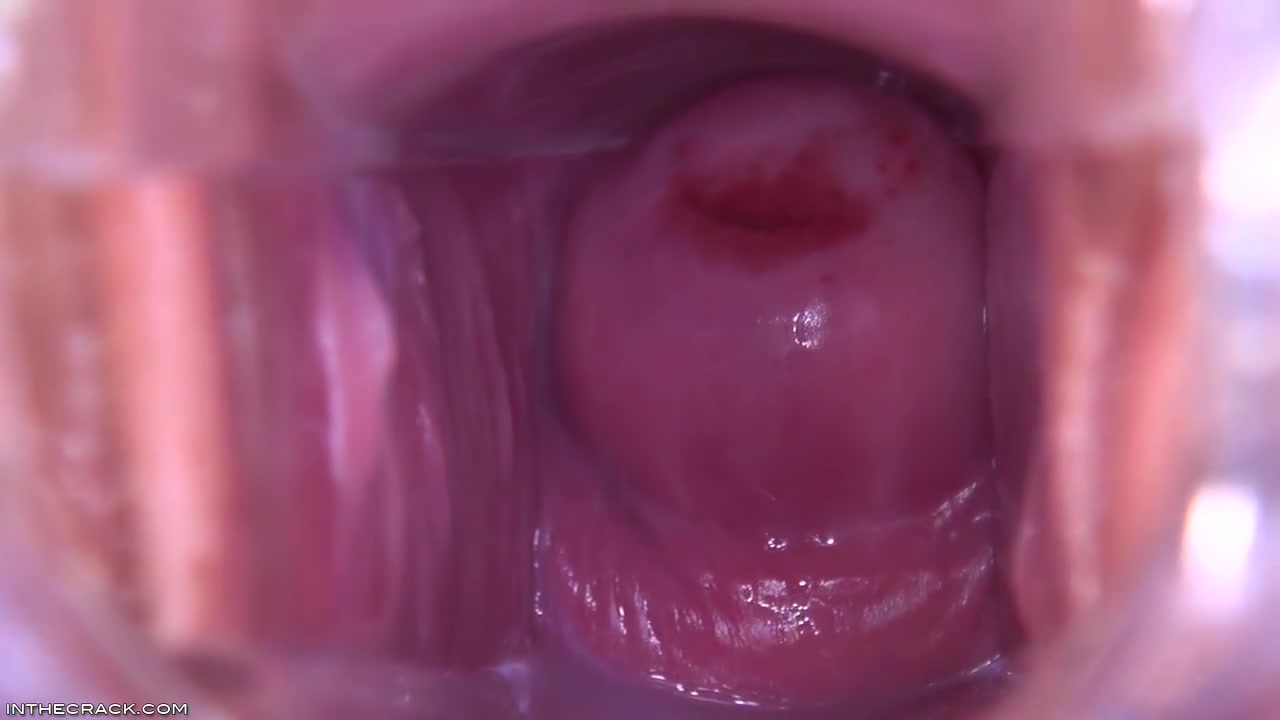 Magnificunt Speculum