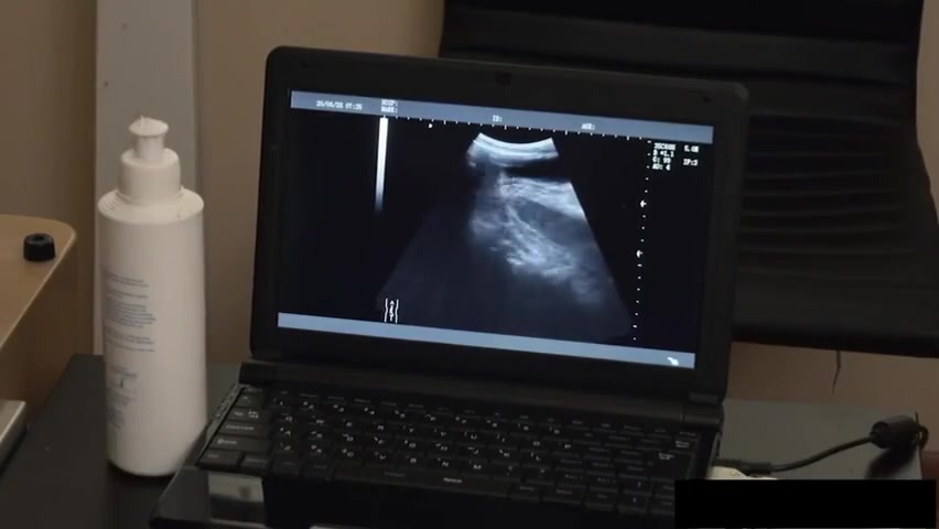 Austin Chez Le Passe Une Ecographie Vid Porn