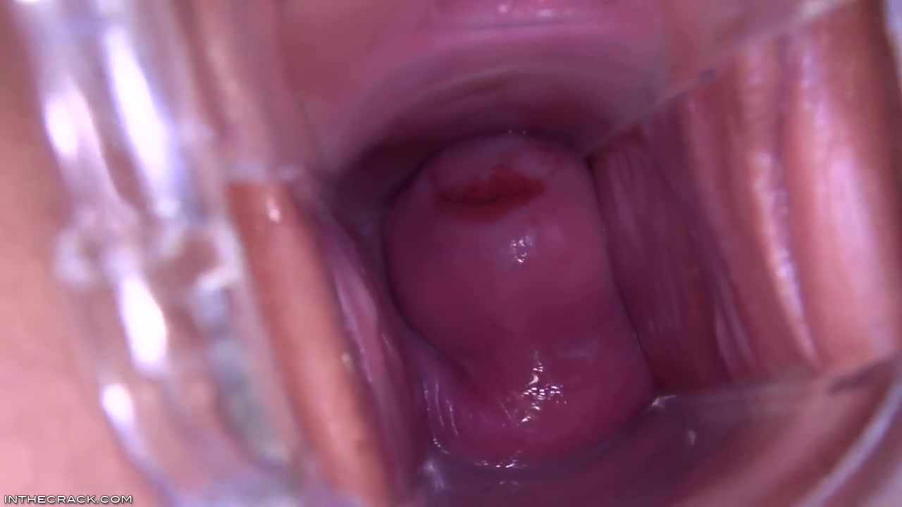 Magnificunt Speculum
