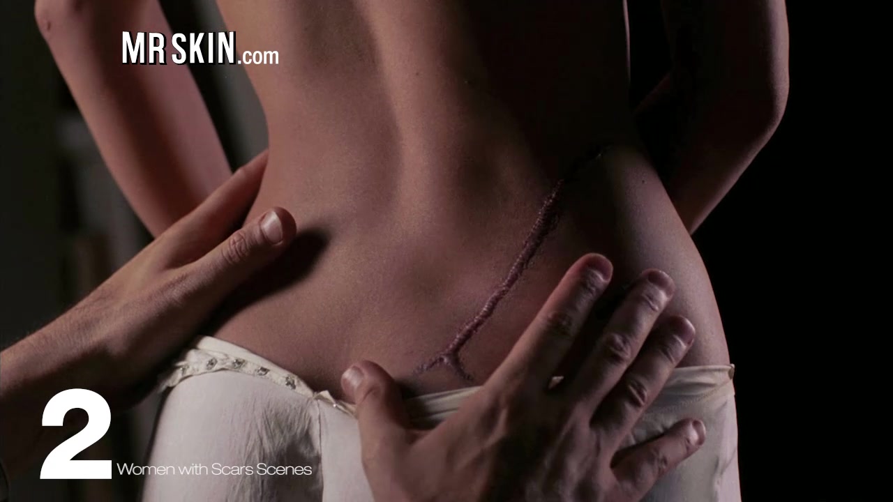 Top 5 Women with Scars Scenes - Mr.Skin