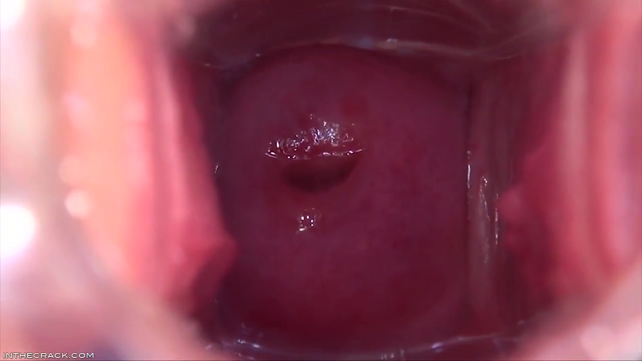 Cervix In The Sky - Shows Off And Denise Sky