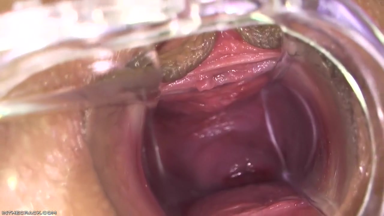 Kari - Peep Hole Providing Cervix