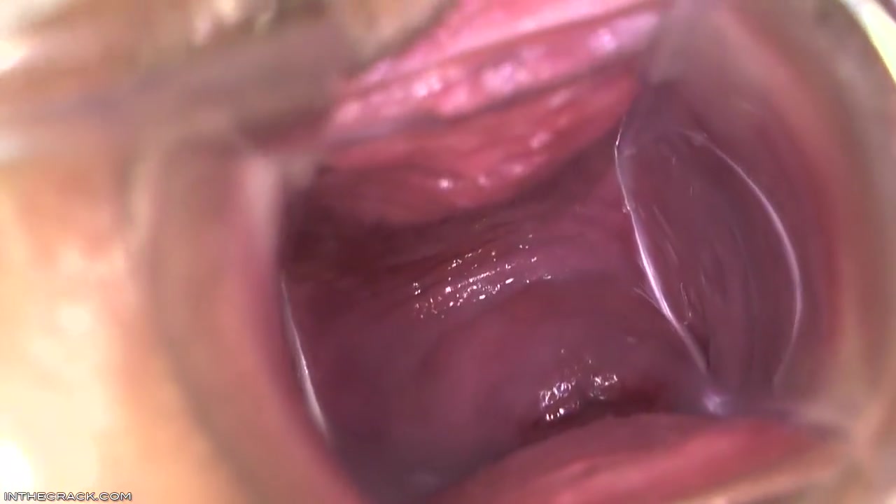 Kari - Peep Hole Providing Cervix