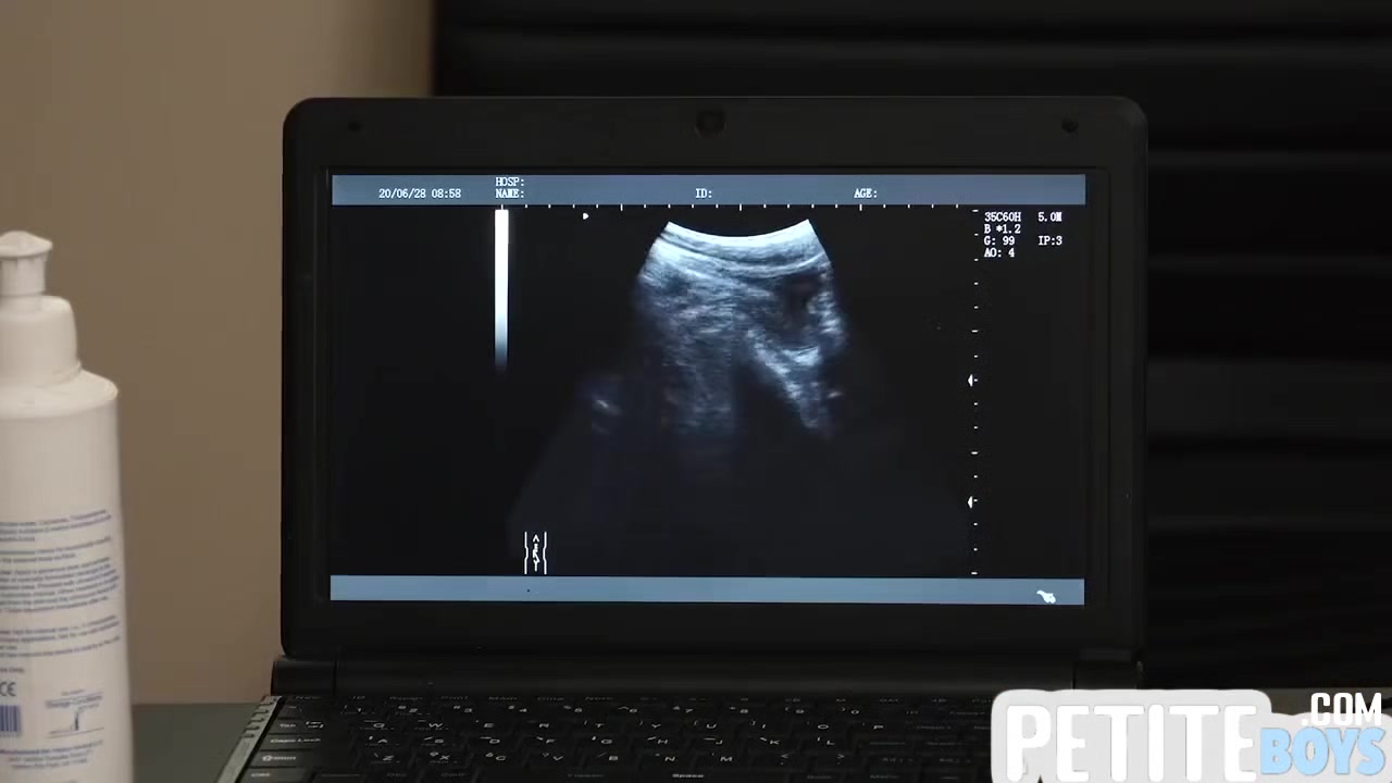 Tiny Barebacked By Handsome Doctor On Ultrasound - Gay Boy