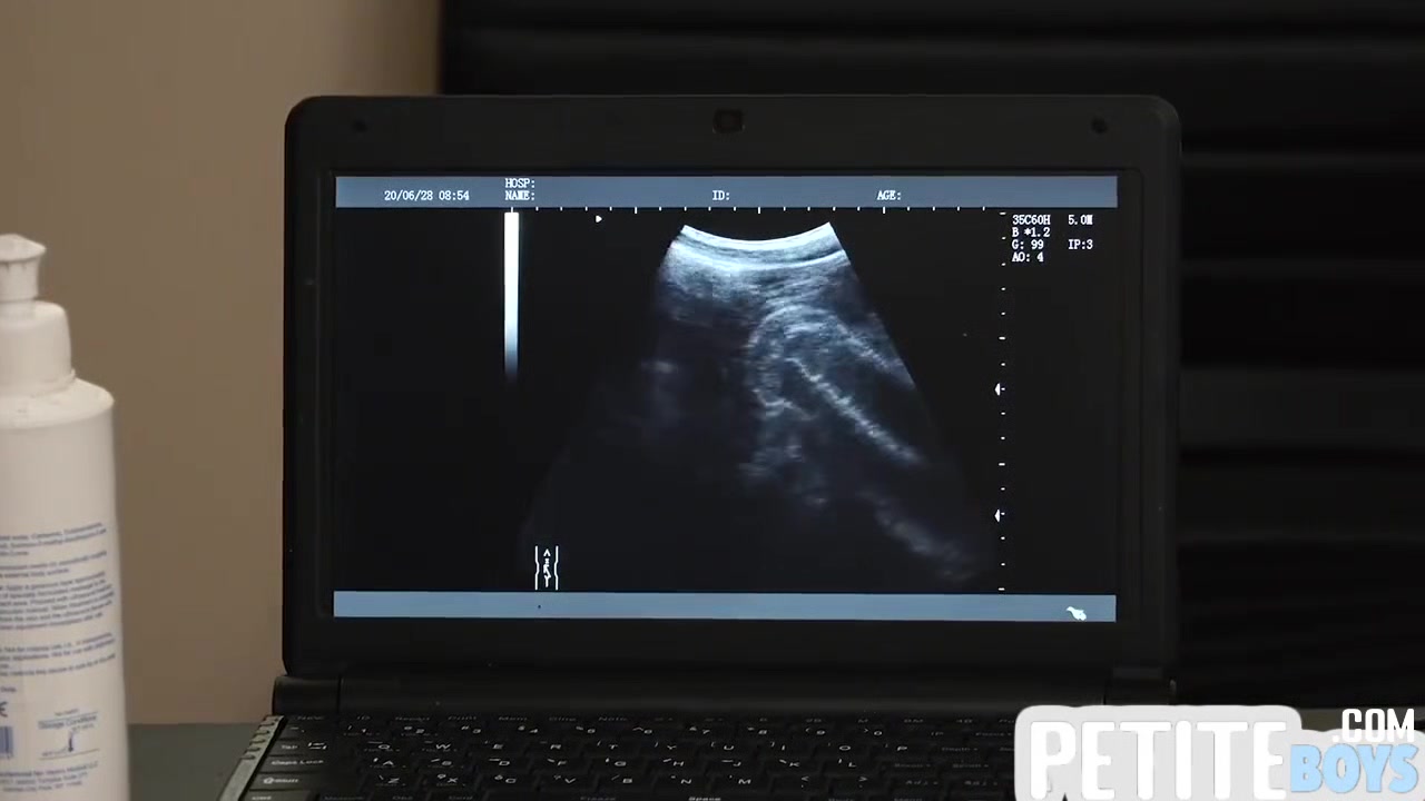 Tiny Barebacked By Handsome Doctor On Ultrasound - Gay Boy