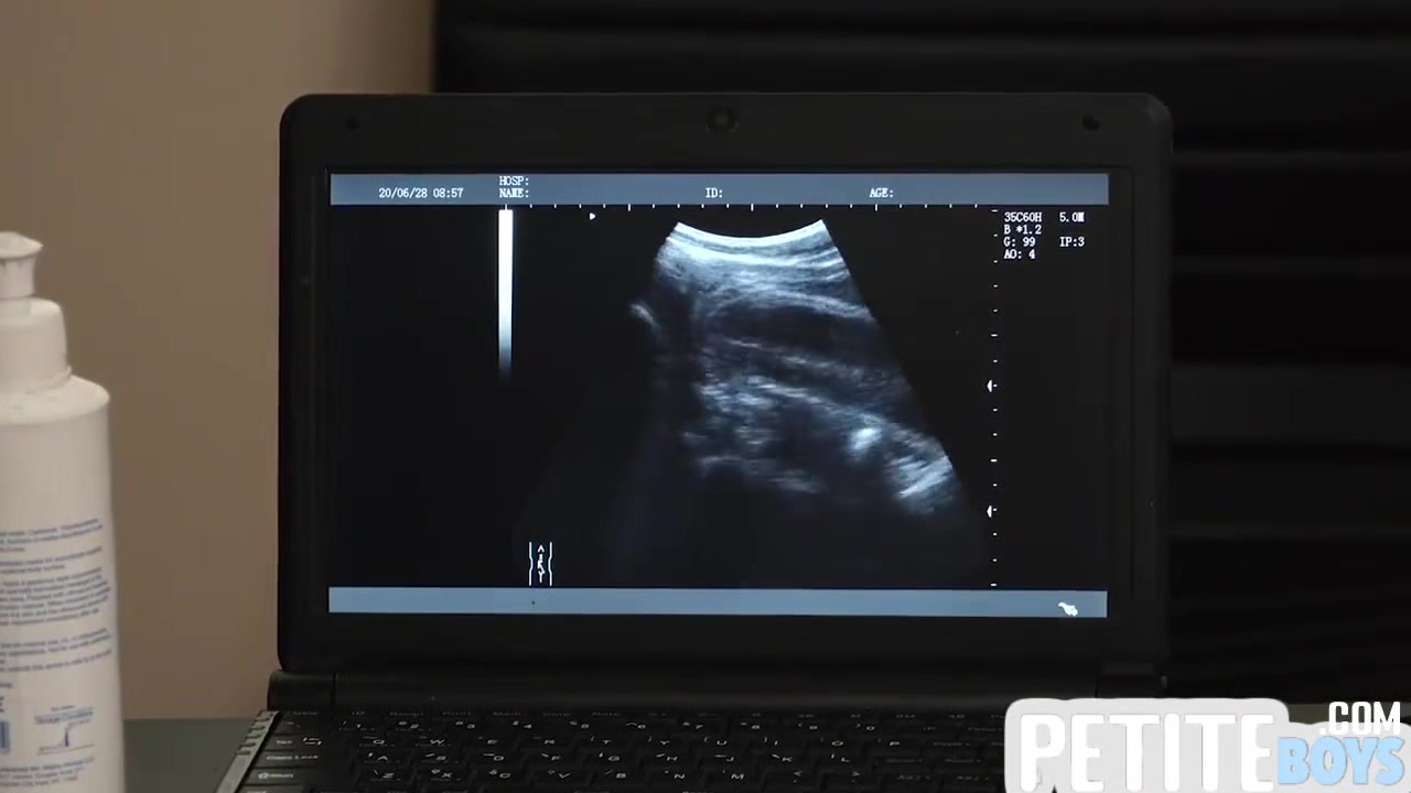 Tiny Barebacked By Handsome Doctor On Ultrasound - Gay Boy
