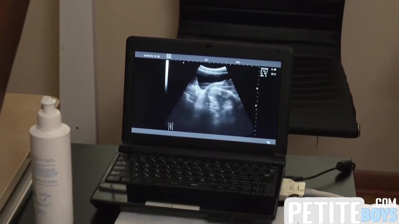 In Petite Barebacked During Ultrasound At Doctor With Gay Boy