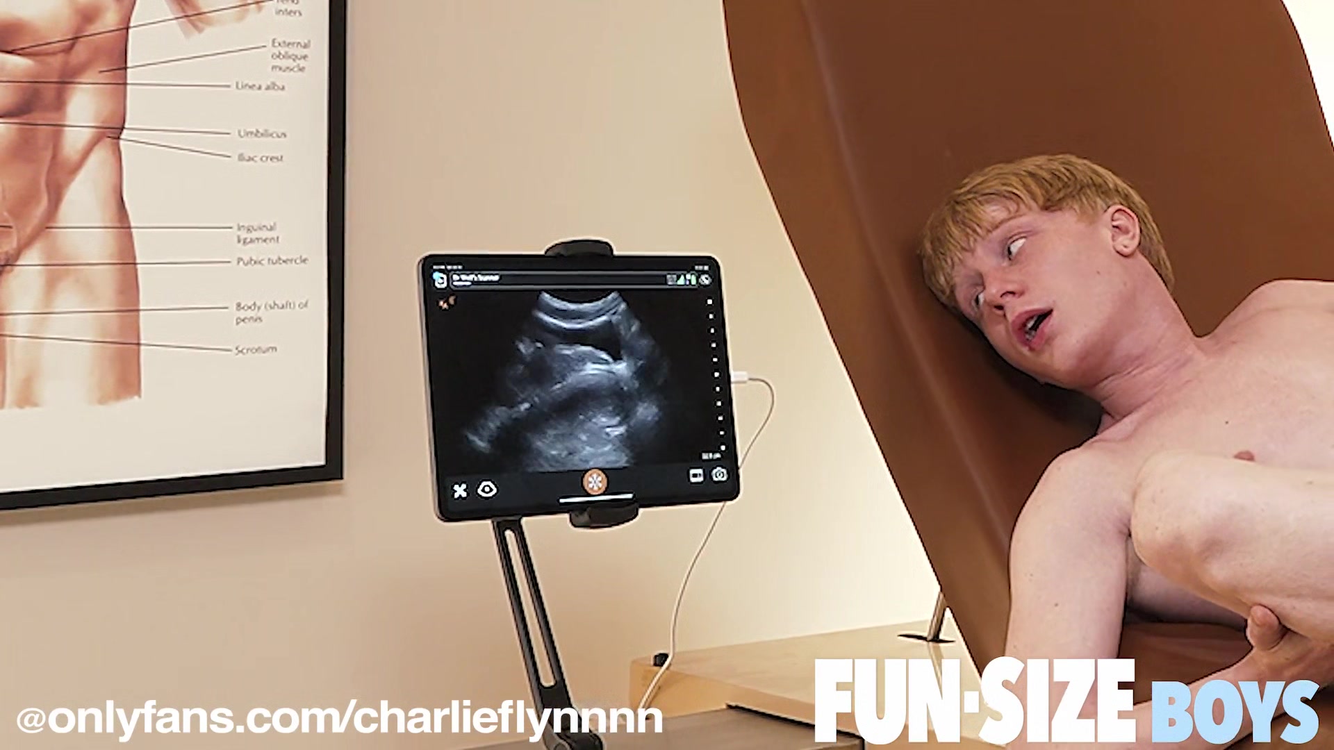 CALEB Chapter 6 - Anal Ultrasound