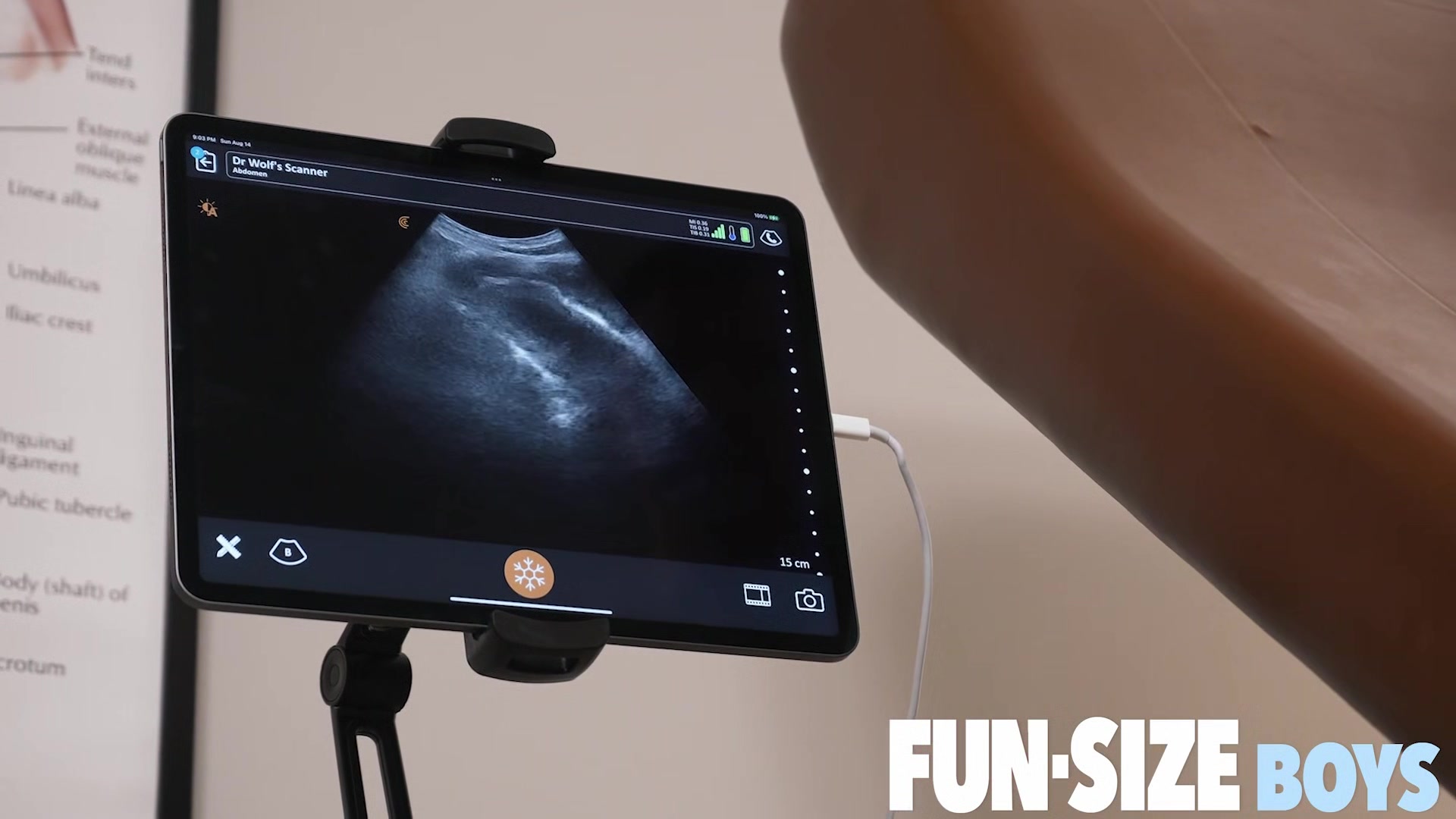 MAX Chapter 3 - Anal Ultrasound