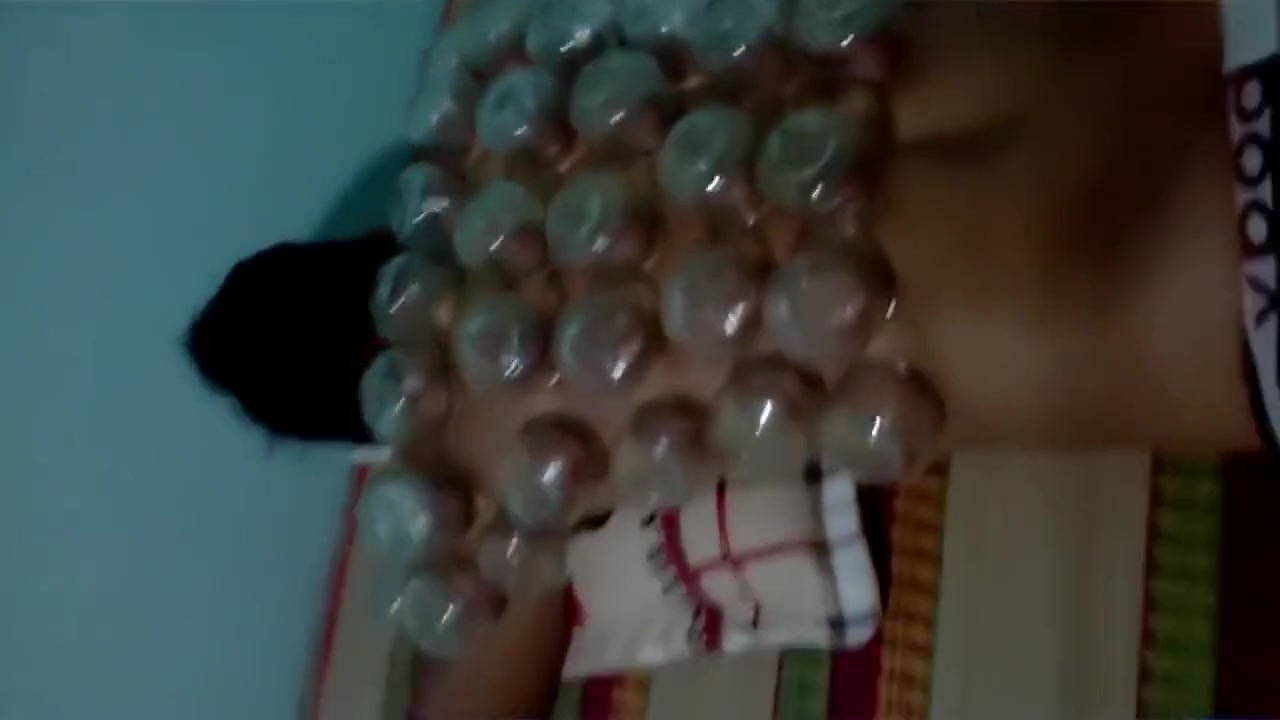 Massage - Cupping