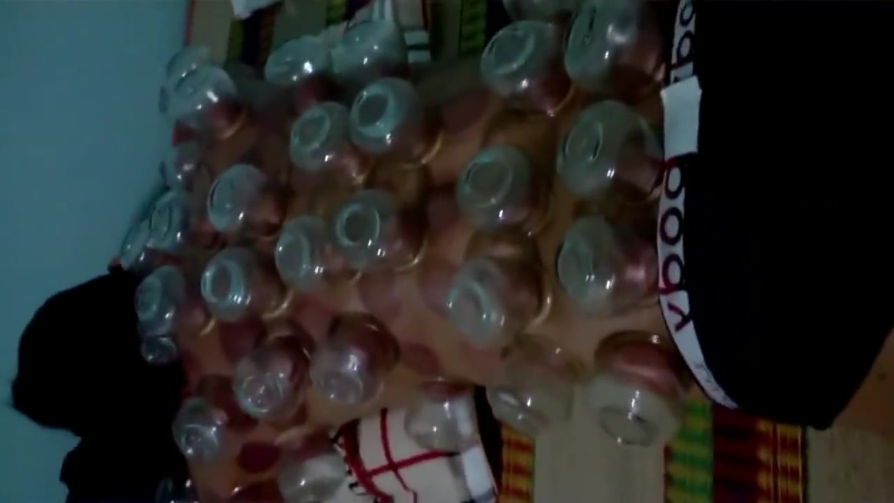 Massage - Cupping