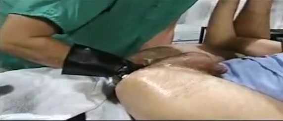 The doctor's orders: fisting is the cure