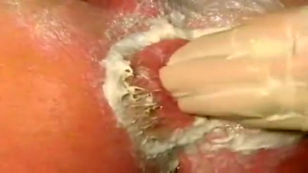 Doctor Receives Stimulation