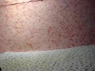 ANAL FISTING AND BIZZARE INSERTIONS