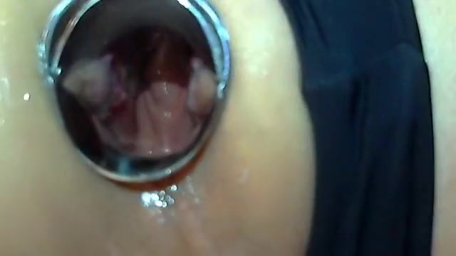 Anal Fisting and Gaping