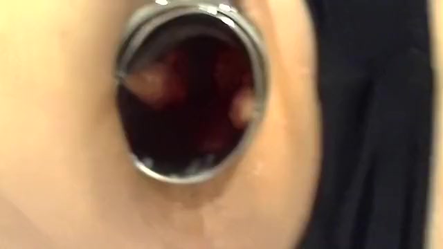Anal Fisting and Gaping