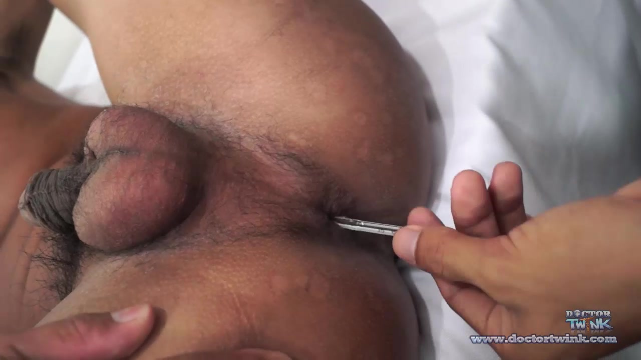 Dr. Argie & Jacob - Anal Penetration Play - DoctorTwink