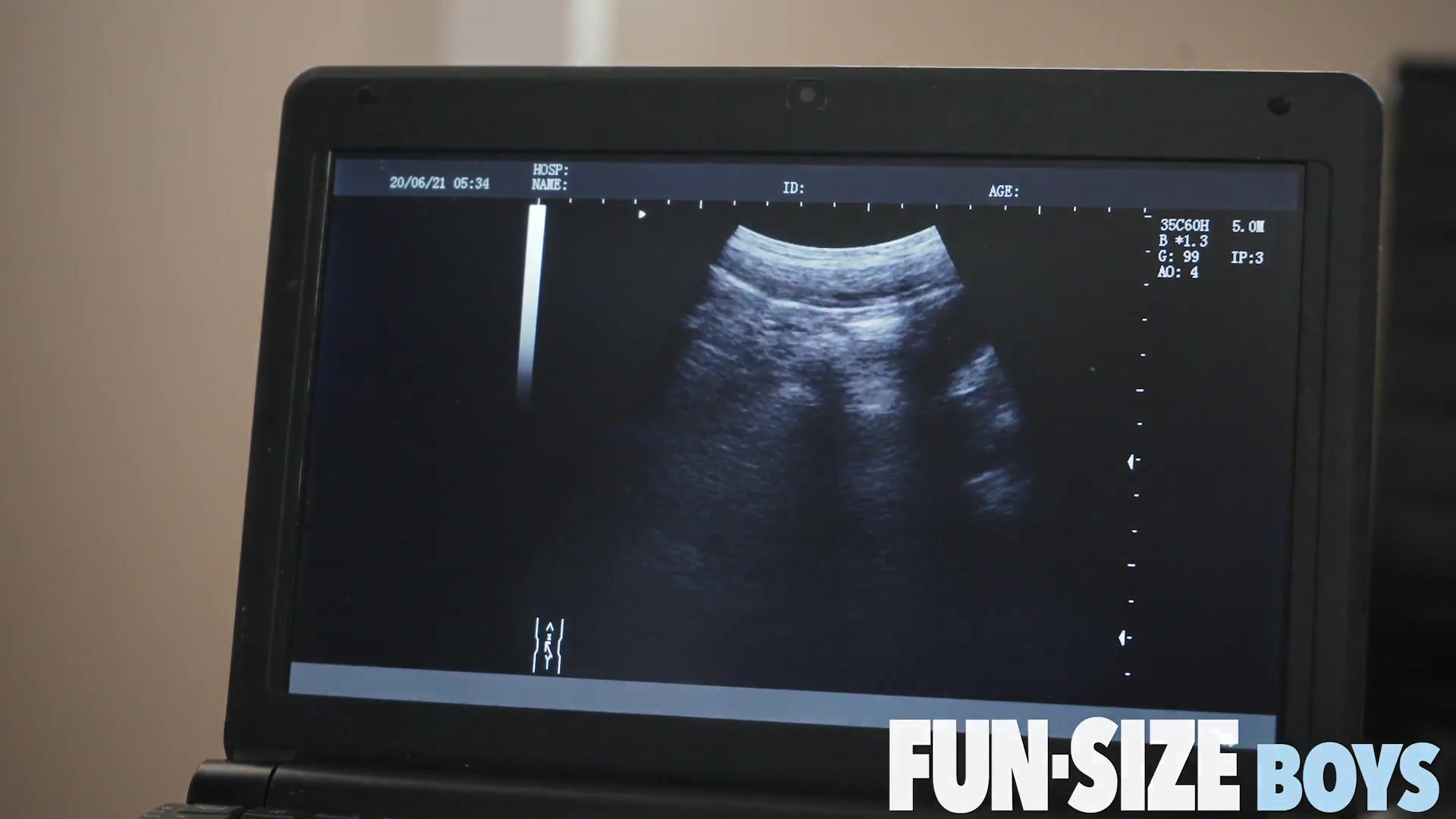LUCAS Chapter 2 - Follow Up Doctor Visit