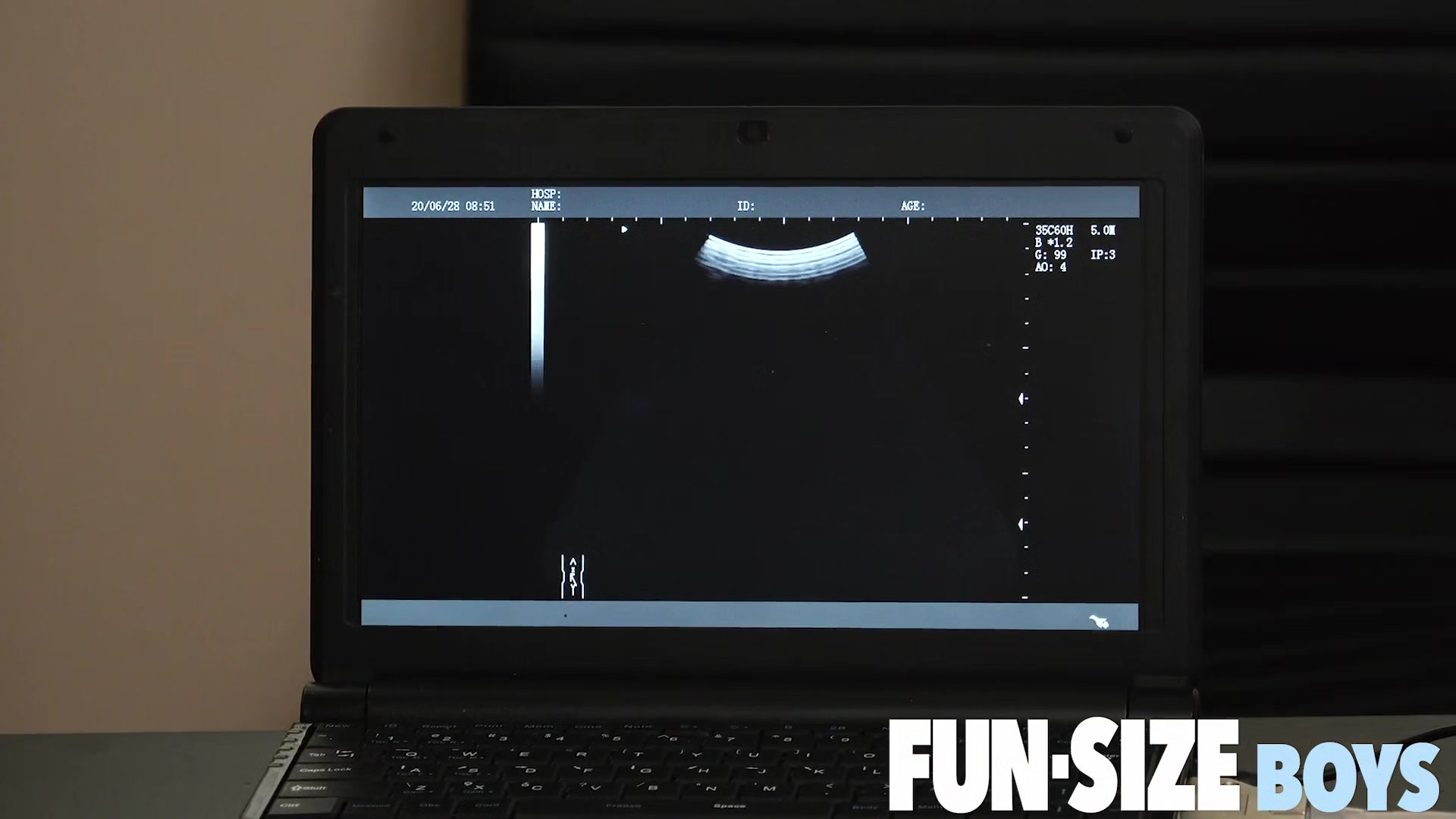 AUSTIN Chapter 19 - Anal X-Ray Vision