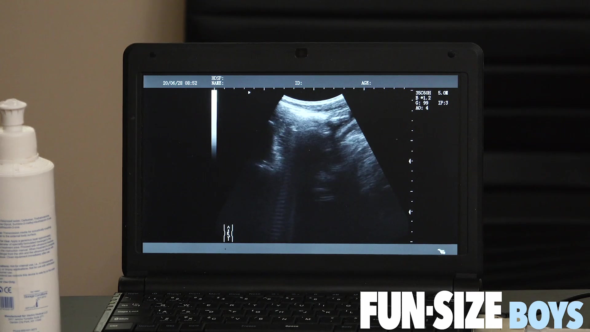 AUSTIN Chapter 19 - Anal X-Ray Vision