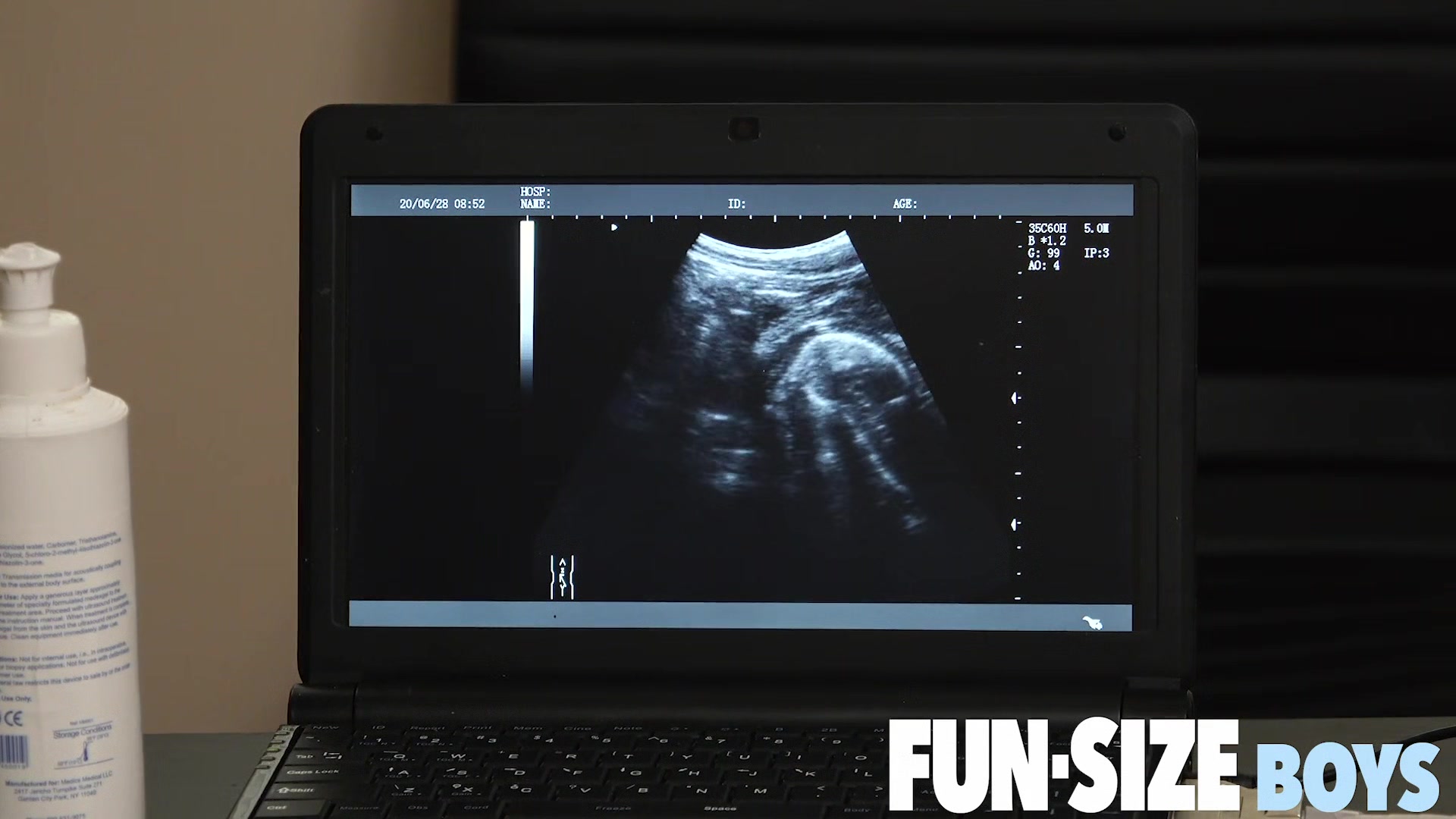 AUSTIN Chapter 19 - Anal X-Ray Vision