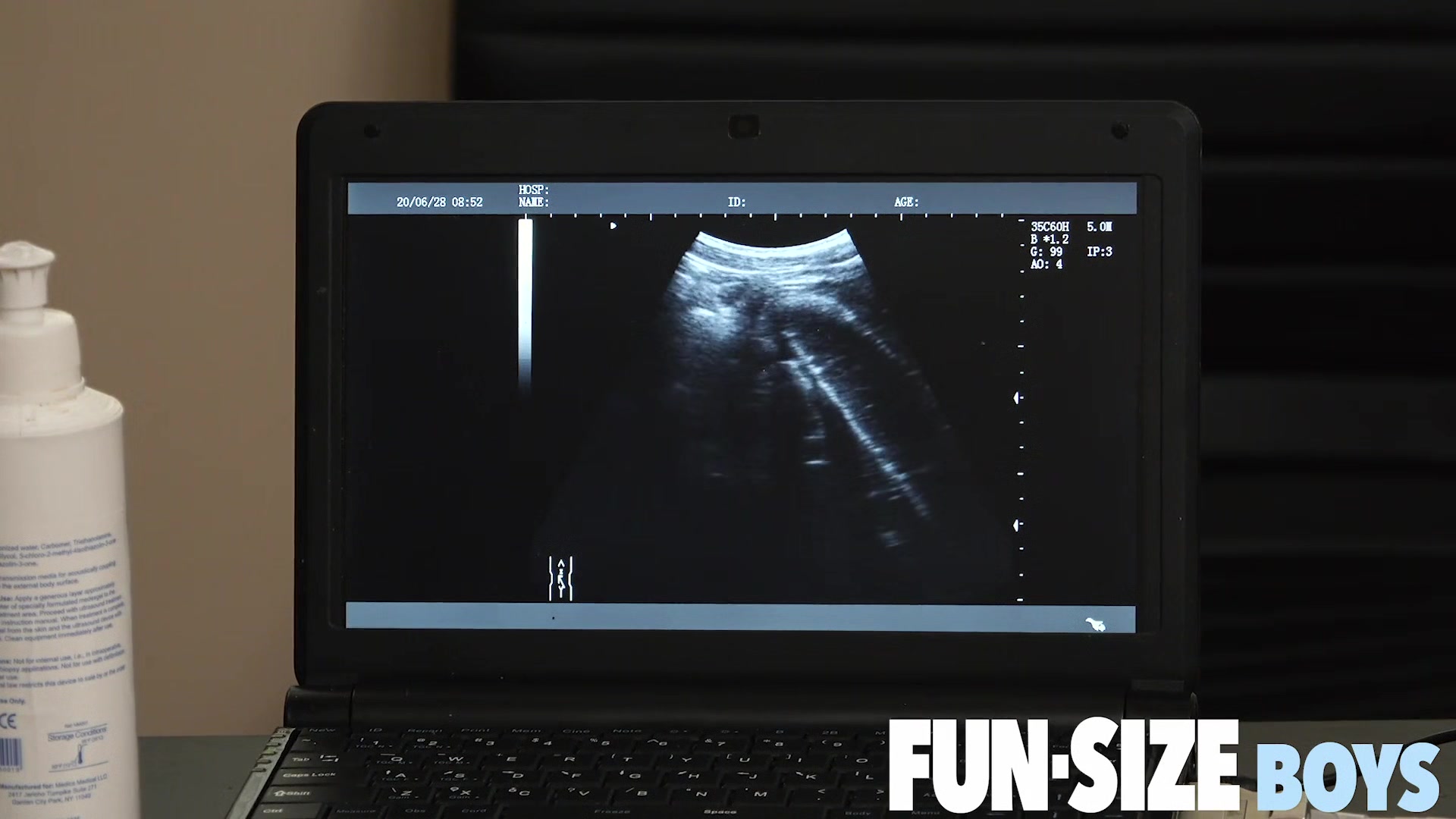 AUSTIN Chapter 19 - Anal X-Ray Vision