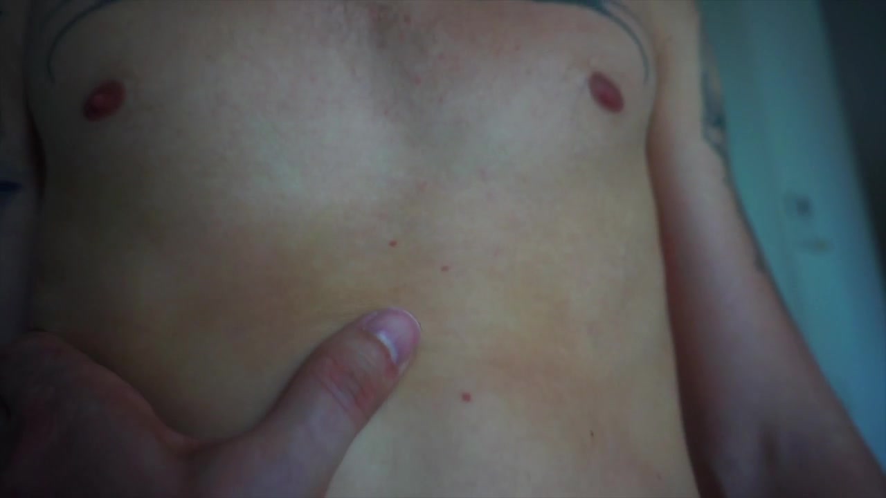 Sore bubble bottom pounded