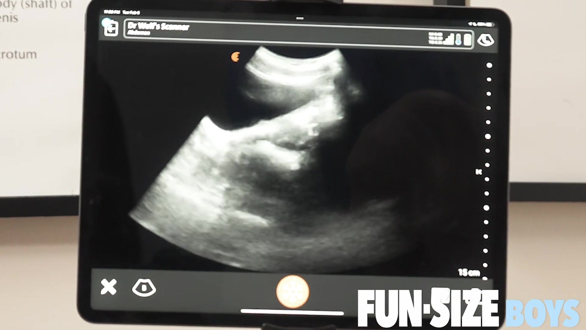Grant Chapter 3 - Anal Ultrasound