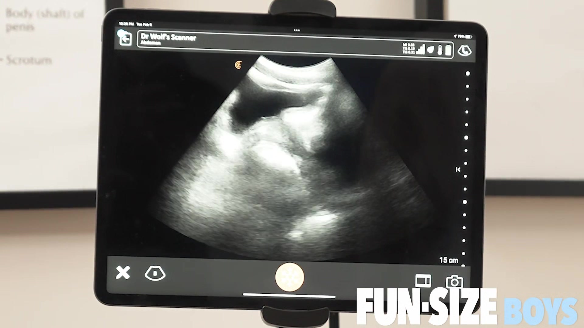 Grant Chapter 3 - Anal Ultrasound