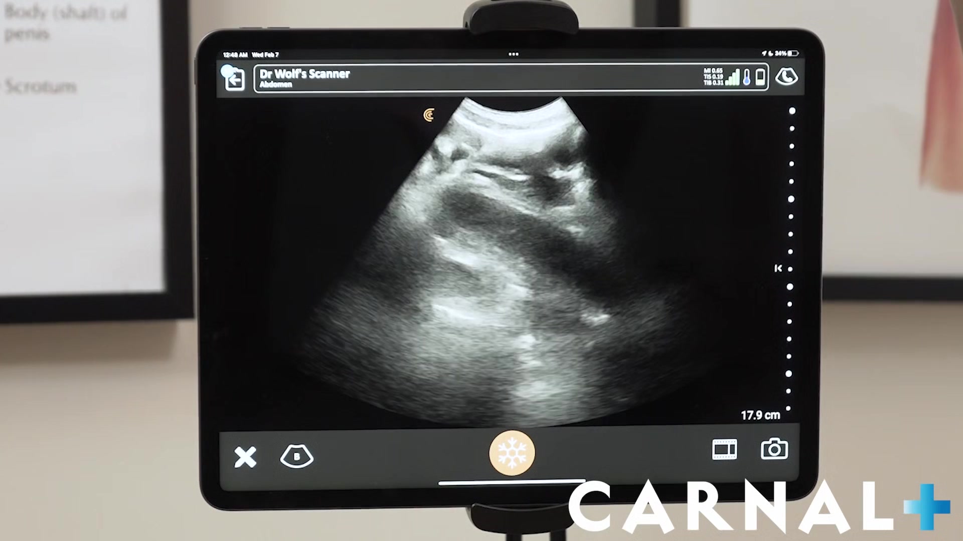 Noah Chapter 4 - Anal Ultrasound