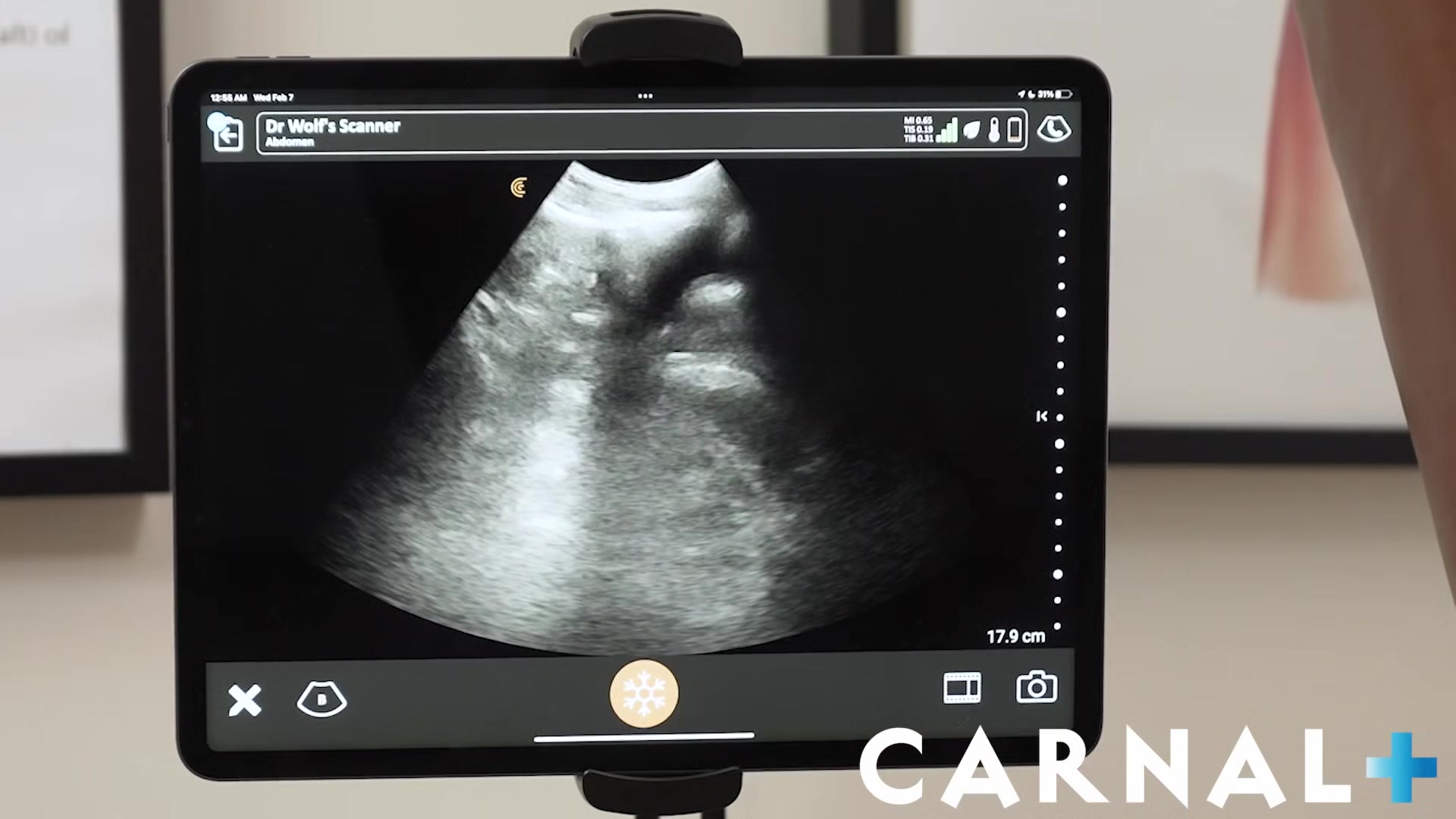 Noah Chapter 4 - Anal Ultrasound