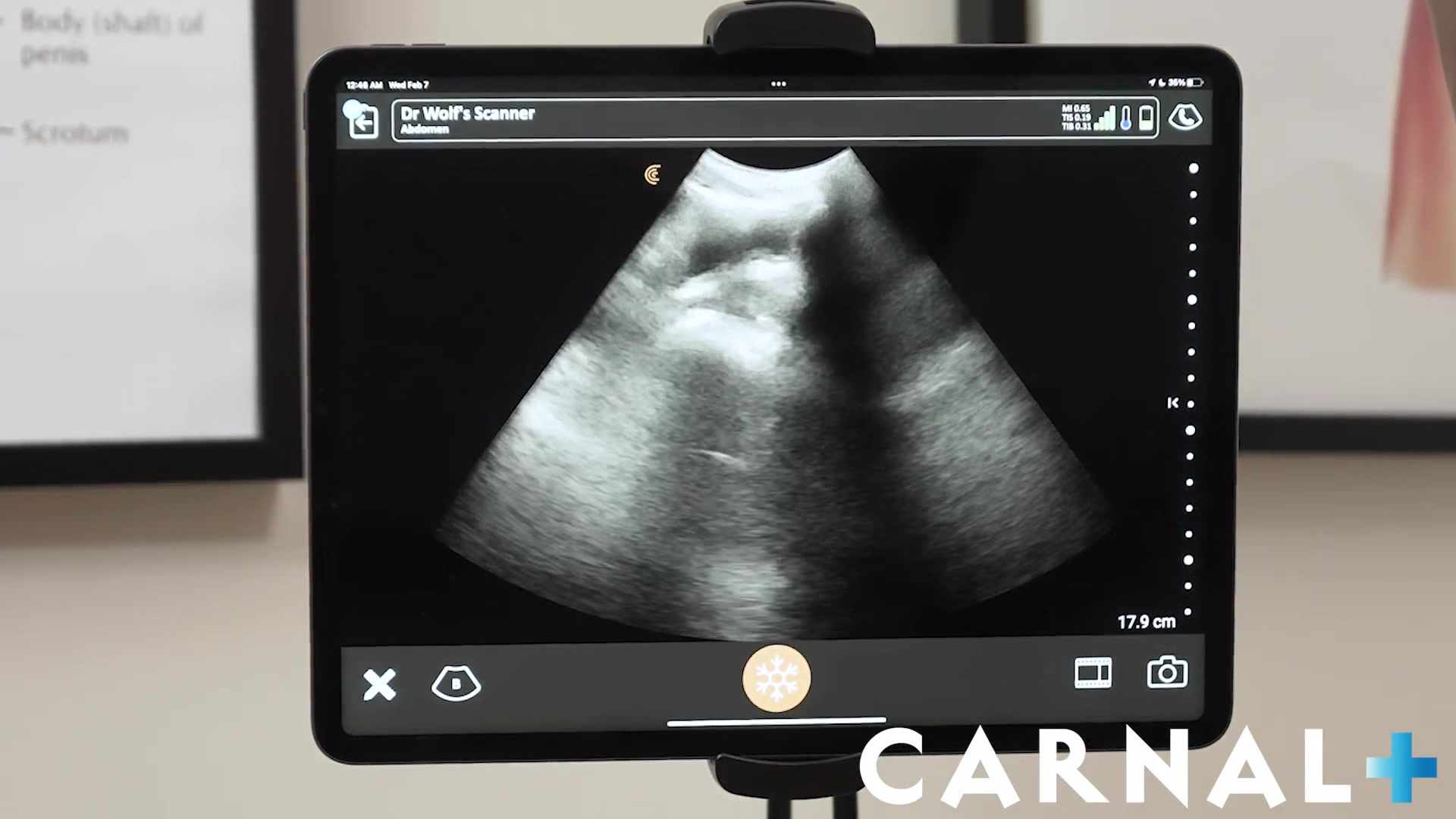 Noah Chapter 4 - Anal Ultrasound