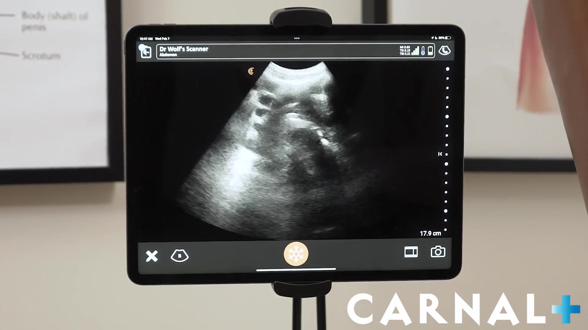 Noah Chapter 4 - Anal Ultrasound