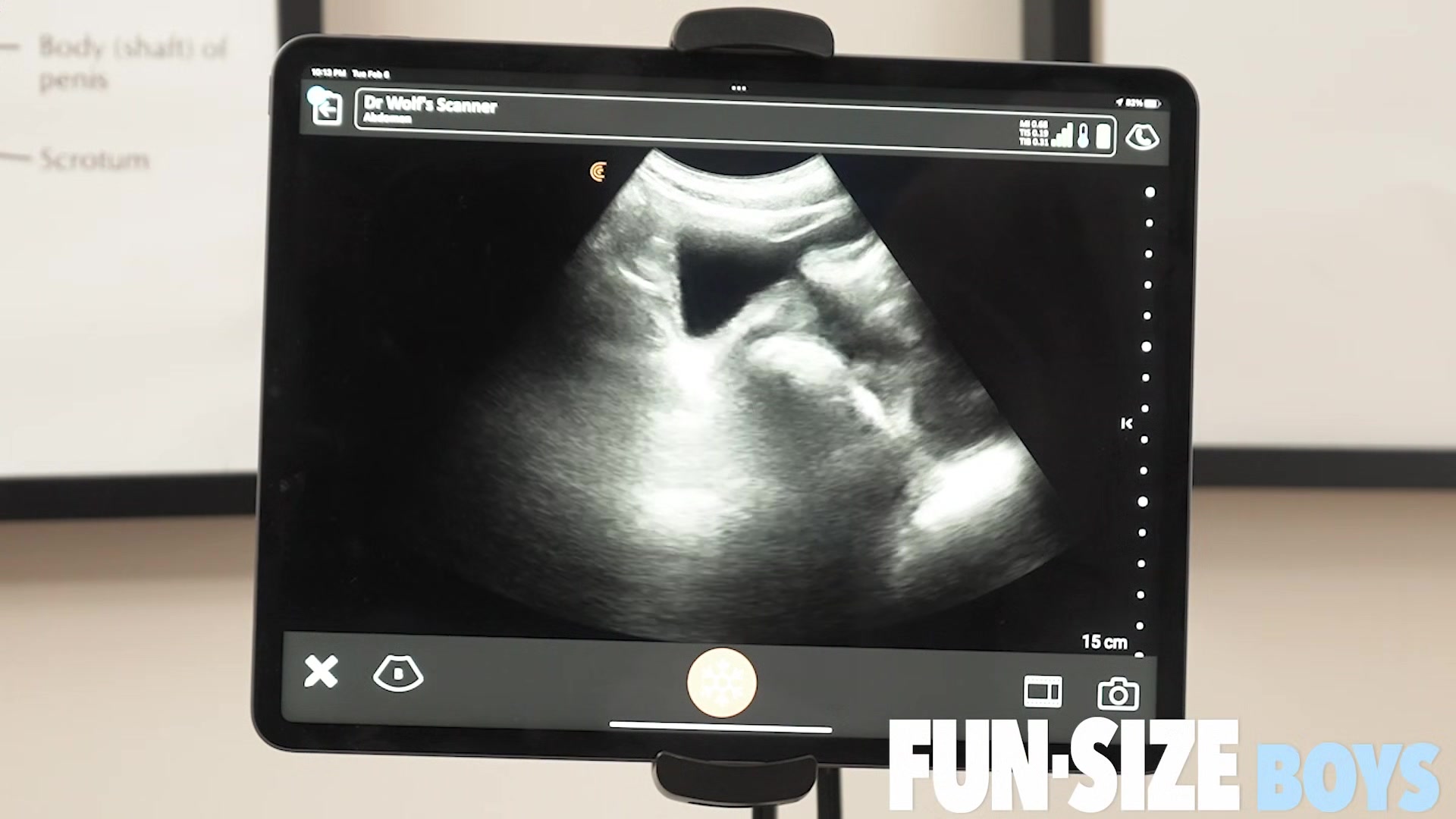 Grant Chapter 3 - Anal Ultrasound