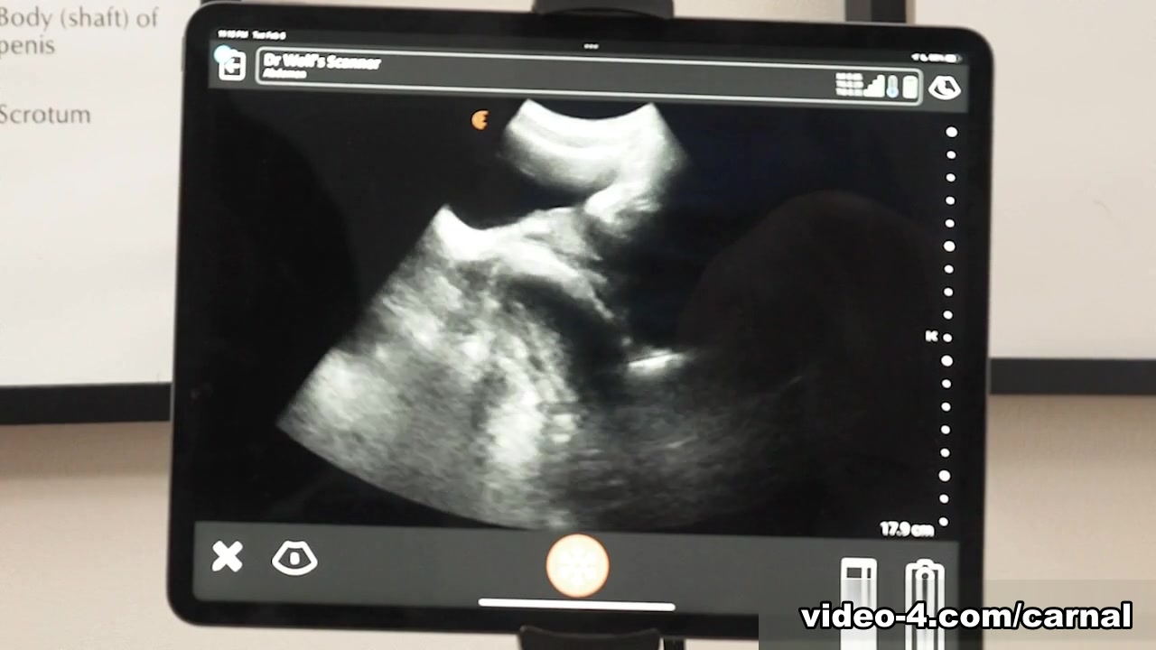 Anal Ultrasound - GRANT Vol. 1 - Carnal Plus