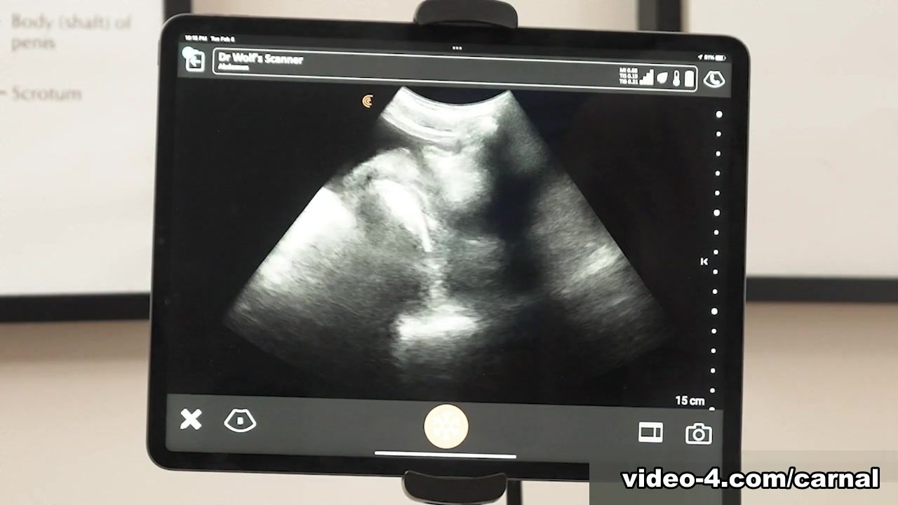 Anal Ultrasound - GRANT Vol. 1 - Carnal Plus
