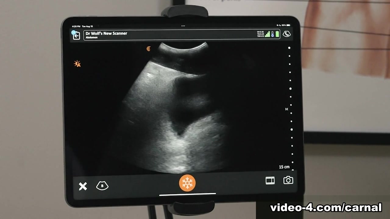 Anal Ultrasound - DAMIEN Vol. 2 - Carnal Plus