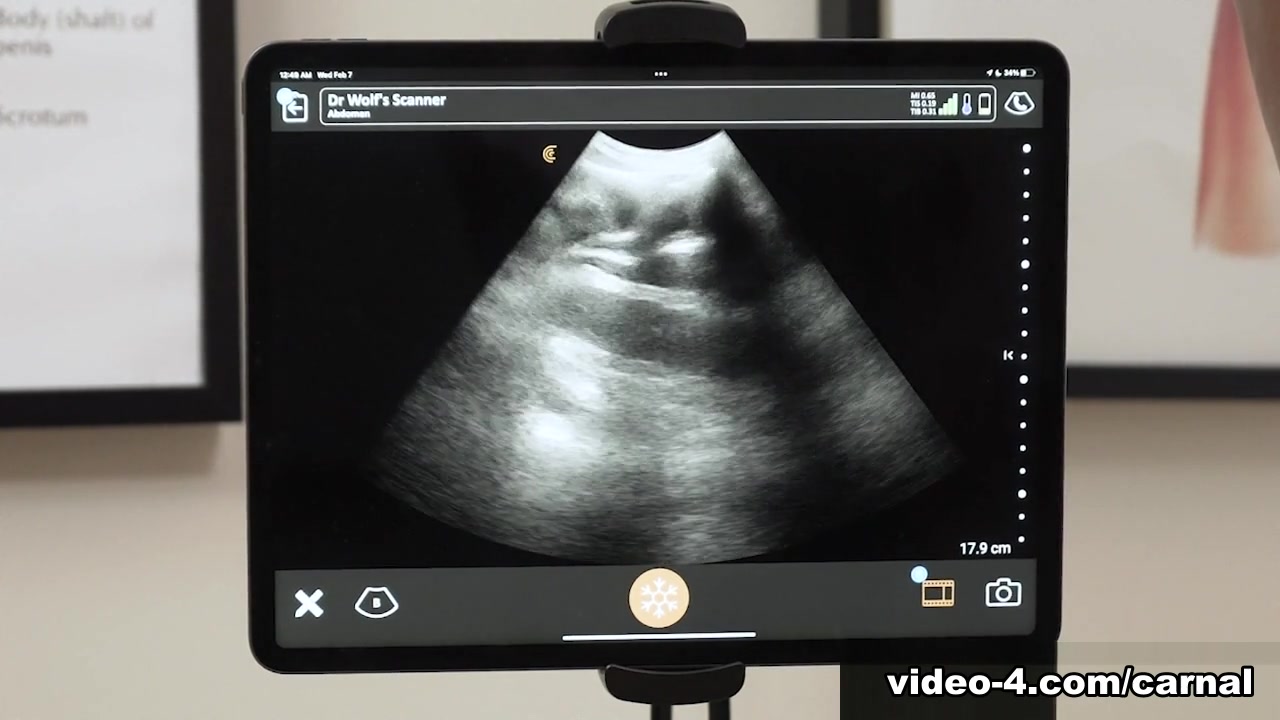Anal Ultrasound - NOAH Vol. 1 - Carnal Plus