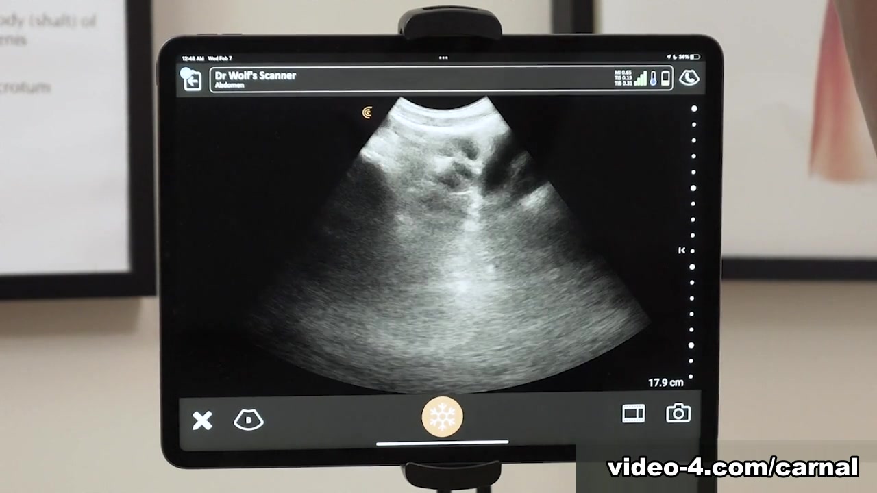 Anal Ultrasound - NOAH Vol. 1 - Carnal Plus