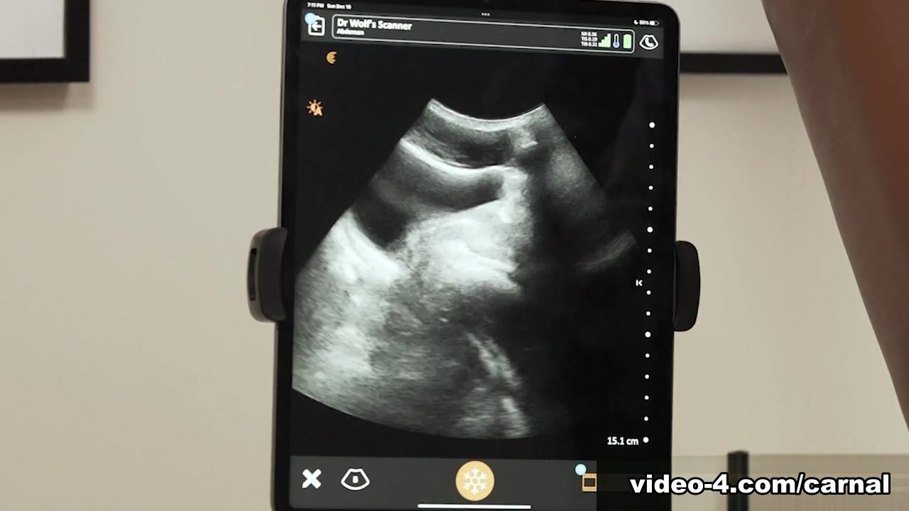 Anal Ultrasound - LOGAN Vol. 2 - Carnal Plus