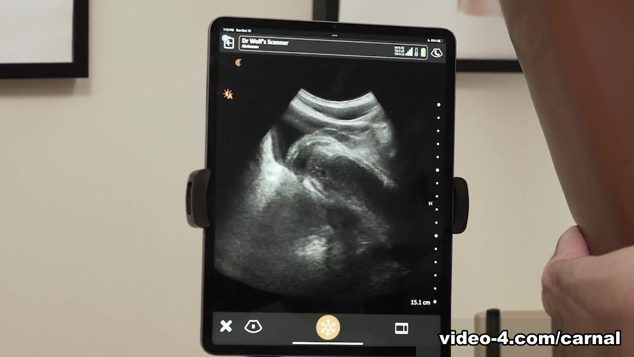 Anal Ultrasound - LOGAN Vol. 2 - Carnal Plus