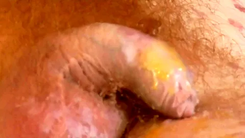 Candle Wax Pt2 - AngelEyes