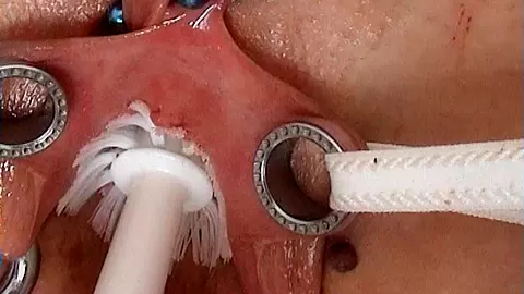 Extreme Anal Fisting, Huge Objects, Cervix Insertion, Peehole Fucking, Nettles, Electro Orgasms and Saline Injection