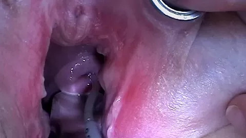 Extreme Anal Fisting, Huge Objects, Cervix Insertion, Peehole Fucking, Nettles, Electro Orgasms and Saline Injection