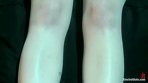 Electrocock Therapy