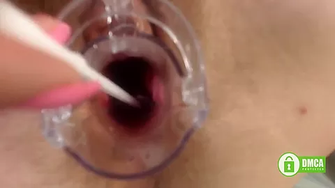Gyno Exam With Speculum Close Up In Hairy Pussy