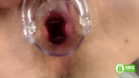 Gyno Exam With Speculum Close Up In Hairy Pussy