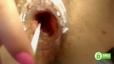 Gyno Exam With Speculum Close Up In Hairy Pussy