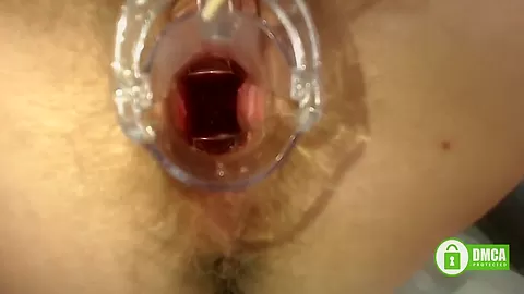 Gyno Exam With Speculum Close Up In Hairy Pussy