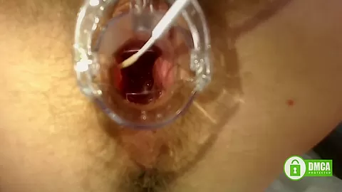 Gyno Exam With Speculum Close Up In Hairy Pussy